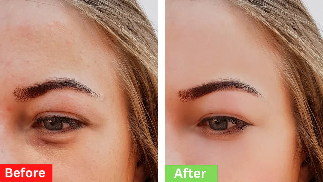 đEarly Christmas Offer â 50% OFF đInstant Firm Eye Tightening Cream