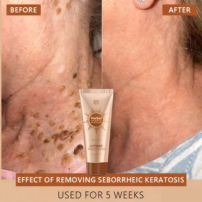 Whitening and Spot-Removing Face Mask Suitable for face and body – 👩‍⚕️ Natural ingredients permanently remove age spots, freckles, sun spots, and liver spots.