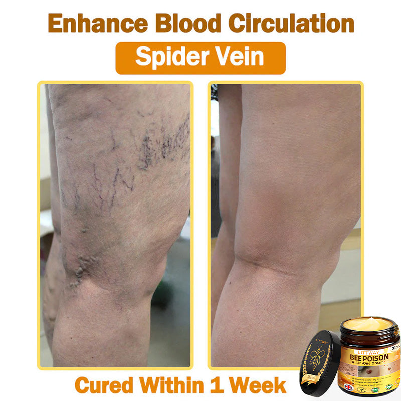 [Official Brand Store] 🐝 LOVILDS® Bee Venom All-In-One Cream (👩‍⚕️British Association of Dermatology 2025 Special Recommendation)