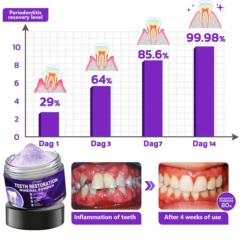 LITTWAY™ Teeth Restoration Mineral Powder