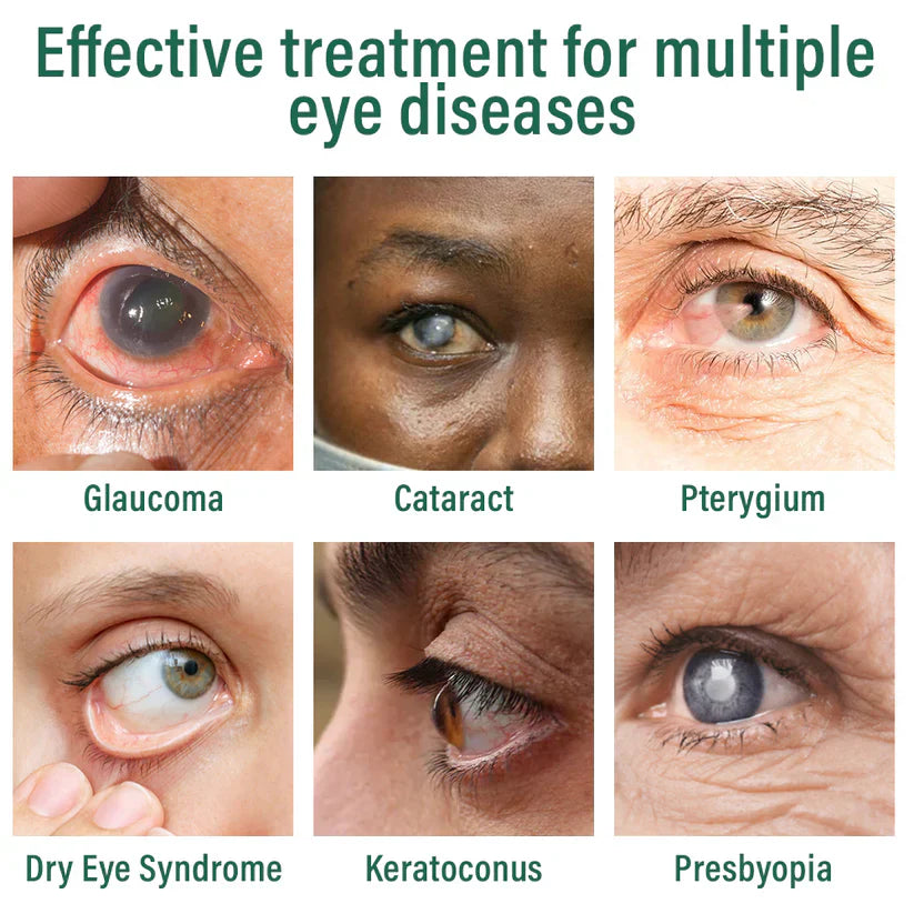 OptiFusion Nano Eye Drops Serum ✅FDA Approved(Suitable for presbyopia, dry eye syndrome, glaucoma, and cataracts) ☘️☘️