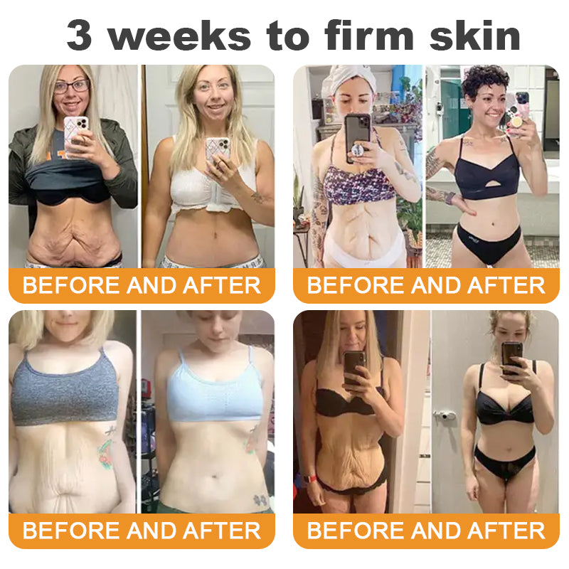 Made and Shipped from USA ✨ LITTWAY™ Bee venom Comprehensive Cream 🔥 LAST DAY 80% OFF 💎💎