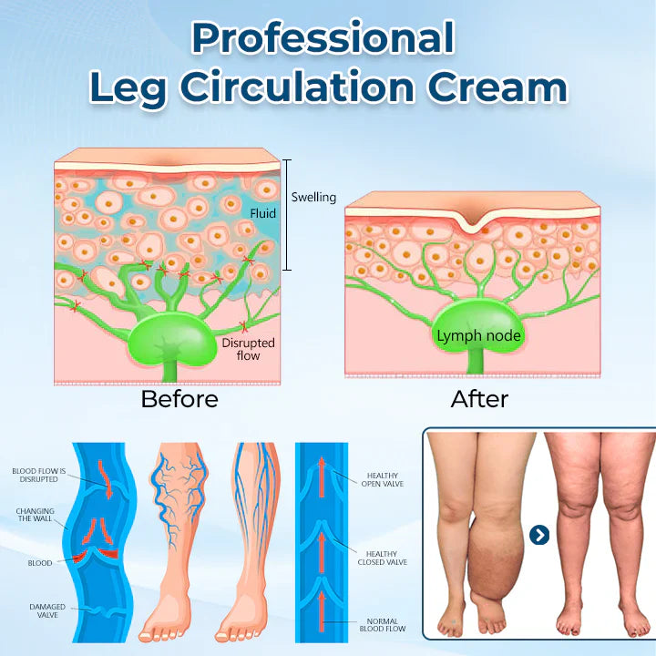 ✅ Official Store: Timilk® LymphoEase Magnesium PCA Roll-On Relief Cream 🔥 FDA Certified (Clinically Proven Relief for Lymphedema, Leg Swelling & Poor Circulation 🩺)