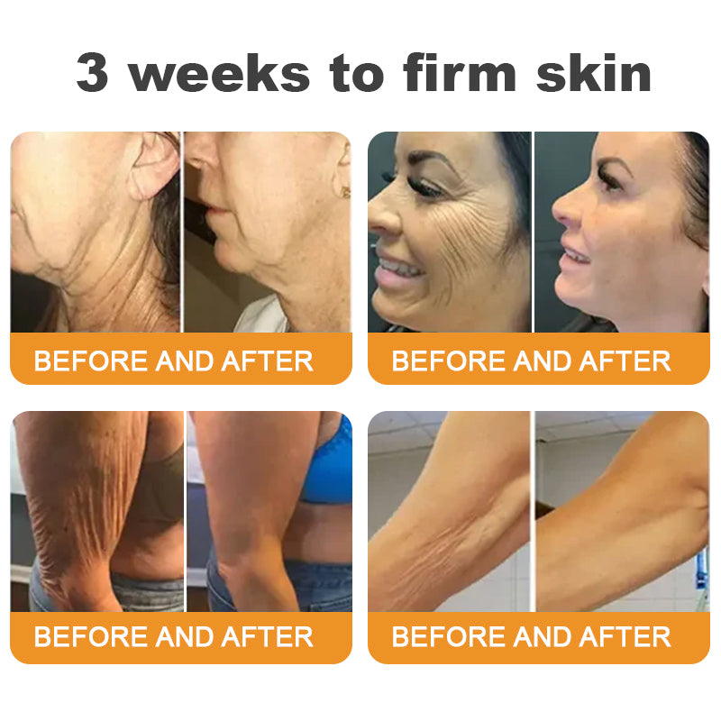 Made and Shipped from USA ✨ LITTWAY™ Bee venom Comprehensive Cream 🔥 LAST DAY 80% OFF 💎💎