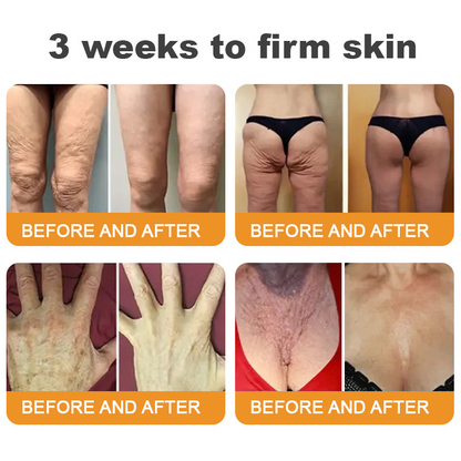 Made and Shipped from USA ✨ LITTWAY™ Bee venom Comprehensive Cream 🔥 LAST DAY 80% OFF 💎💎