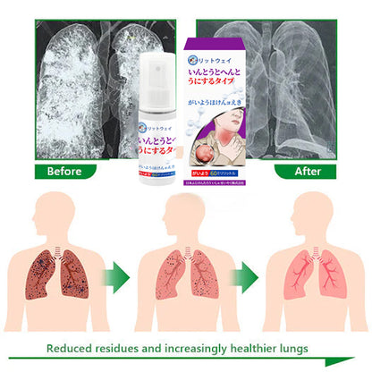 🔥Last Day Promotion 80% OFF - LITTWAY™ Advanced Throat & Lung Spray