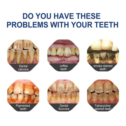 🔥3 Hours Left: 60% OFF LITTWAY™ Toothpaste for Sensitive Teeth