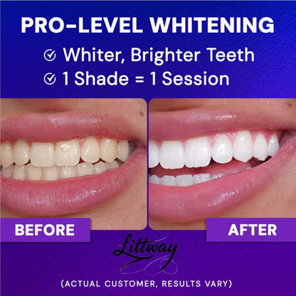 ✨ Littway™ Wireless Gel Teeth Whitening Device