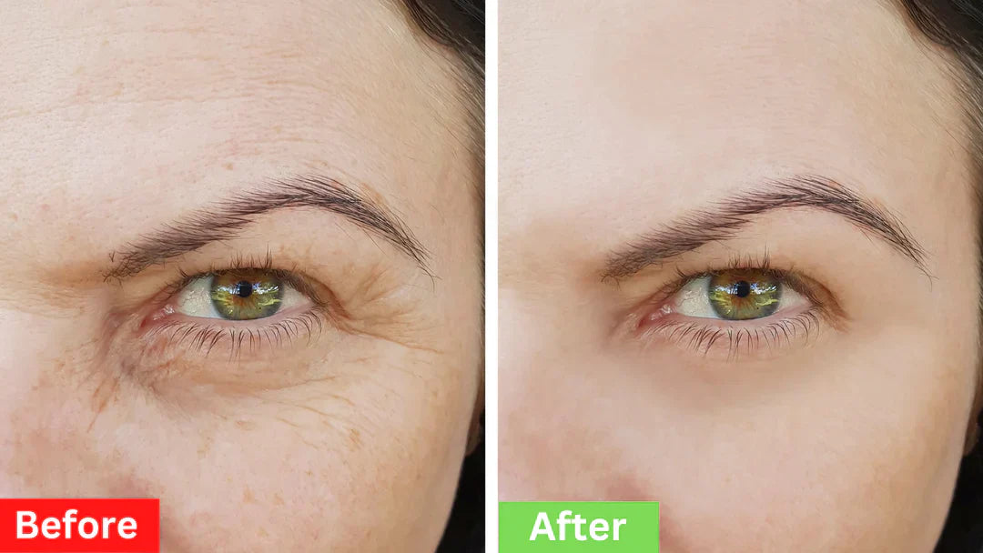 🎄Early Christmas Offer – 50% OFF 🎁Instant Firm Eye Tightening Cream