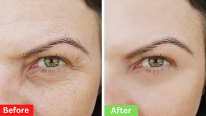 🎄Early Christmas Offer – 50% OFF 🎁Instant Firm Eye Tightening Cream