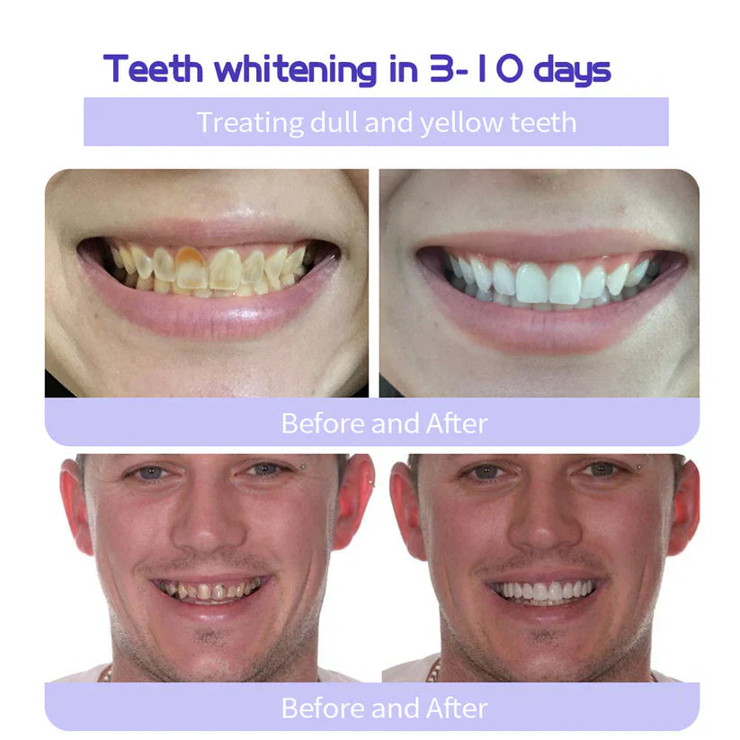 🔥3 Hours Left: 60% OFF LITTWAY™ Toothpaste for Sensitive Teeth