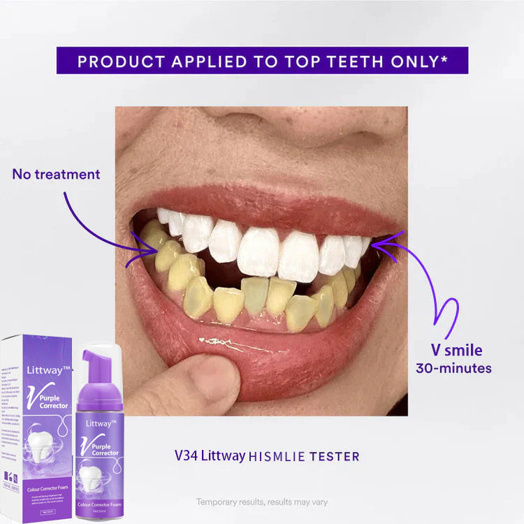 Smile Bright in Just 3 Days—Littway™ V Smile Whitening Toothpaste