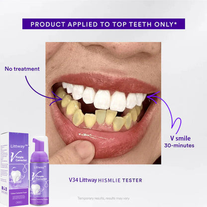 Smile Bright in Just 3 Days—Littway™ V Smile Whitening Toothpaste