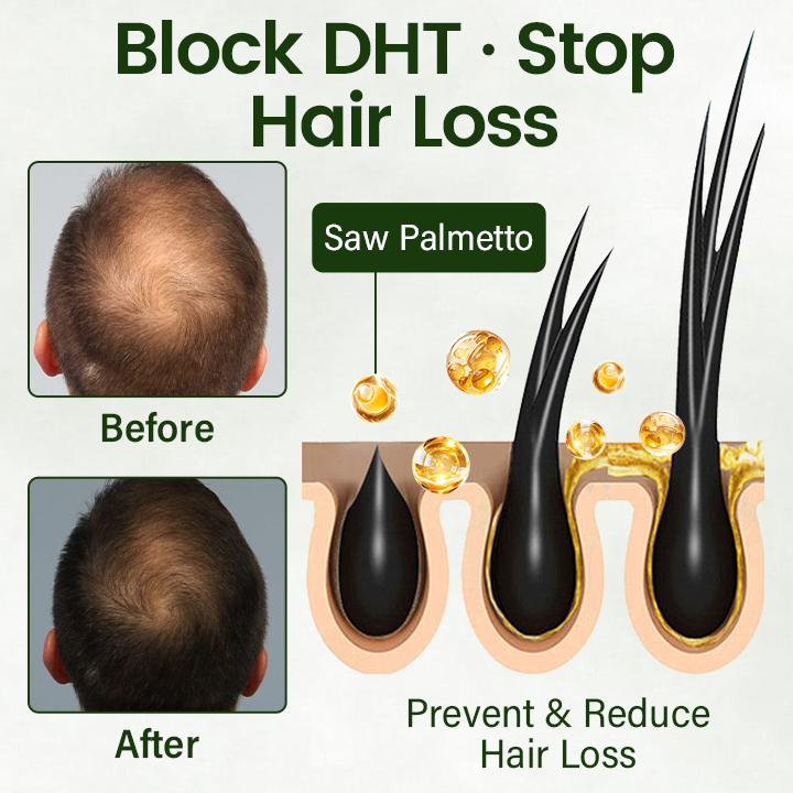 LITTWAY® Follicure BioGrow Hair Restoration Spray ( Reawaken Your Roots. Regrow Naturally. ✨ Clinically Proven Hair Regrowth Within 4 Weeks ✨)